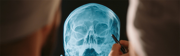 how head injuries are harmful / डोक्याच्या दुखापती किती हानिकारक आहेत