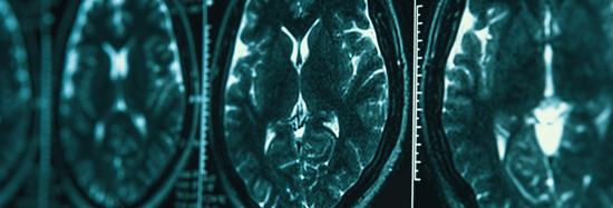best Treatment of Head-Injuries/ डोक्याच्या दुखापतींवर सर्वोत्तम उपचार