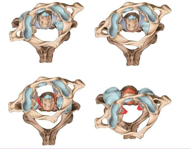अ‍ॅटलांटो-अ‍ॅक्सियल-डिस्लोकेशन मानसिक स्वास्थ्य विचारात्मक स्वास्थ्य सकारात्मक स्वास्थ्य डॉ. रवींद्र आर. पाटील समर्थ न्यूरो आणि सुपरस्पेशालिटी हॉस्पिटल, मिरज.