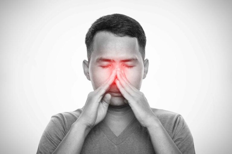 Maxillary Sinusitis
